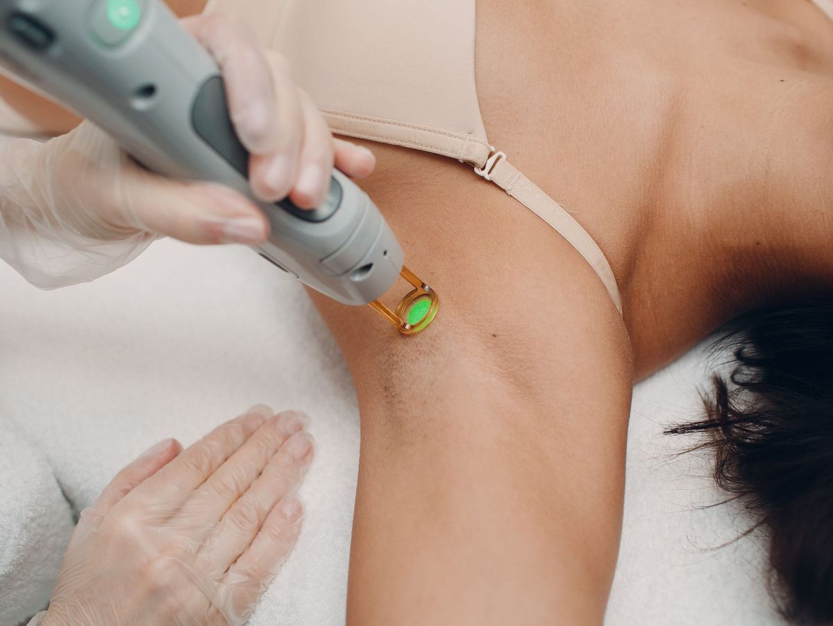 Epilation définitive : laser, lumière pulsée ou électrolyse ?