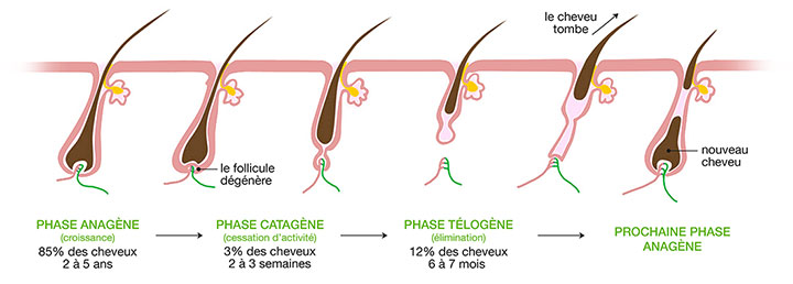 Epilation définitive : laser, lumière pulsée ou électrolyse ?