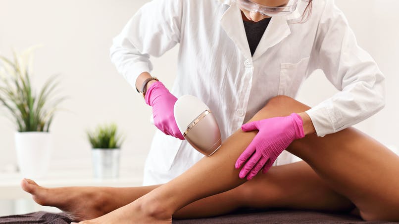 Epilation définitive : laser, lumière pulsée ou électrolyse ?