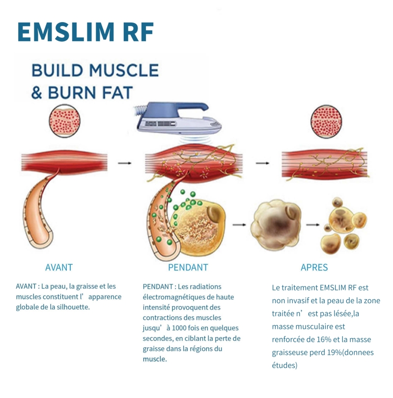 Machine emslim