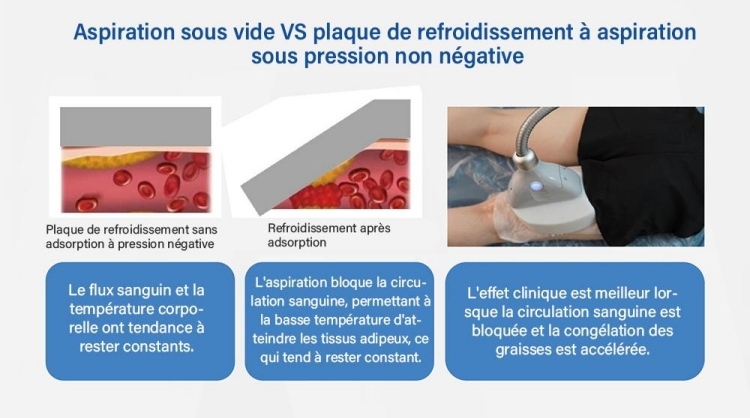 Machine de Coolsculpting 360 Coolplas