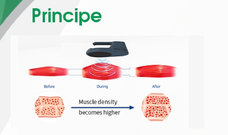 Machine Hiemt pour la Perte de Poids et le Renforcement Musculaire avec RF