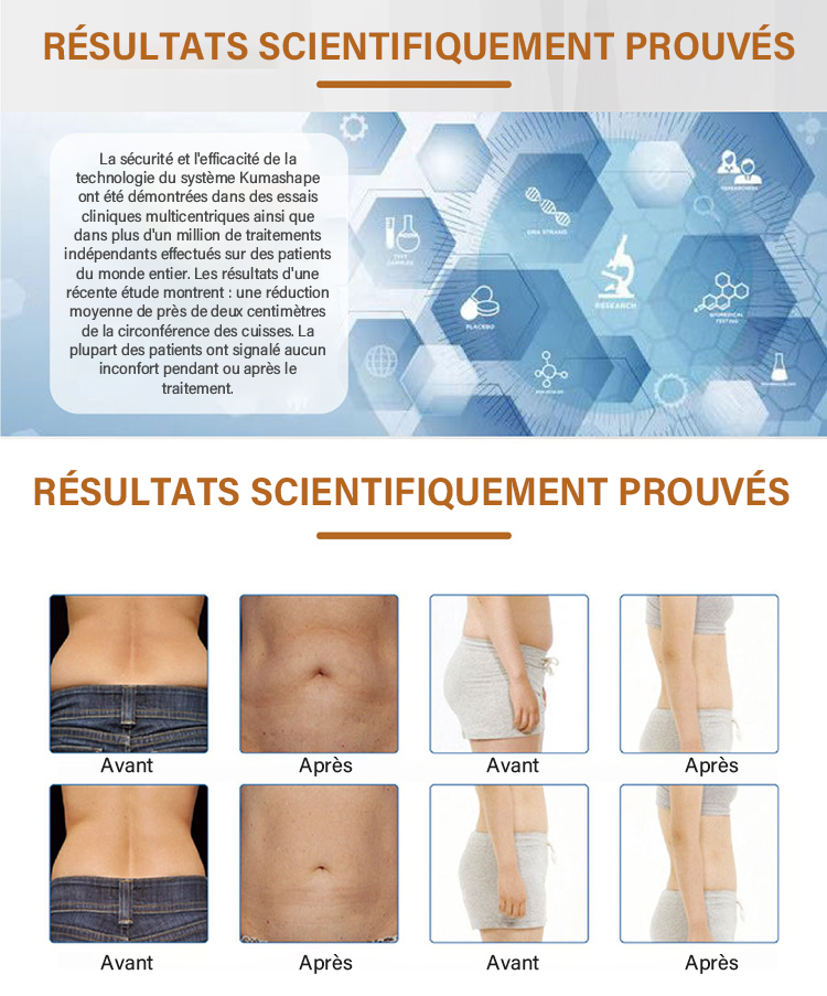 Machine d'amincissement Kuma Shape Pro par cavitation RF