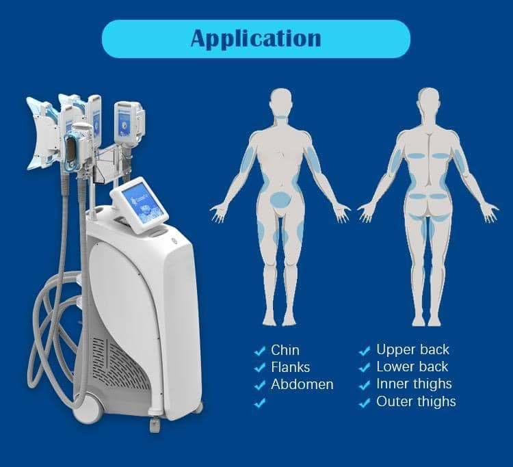 À quoi sert la cryolipolyse ?