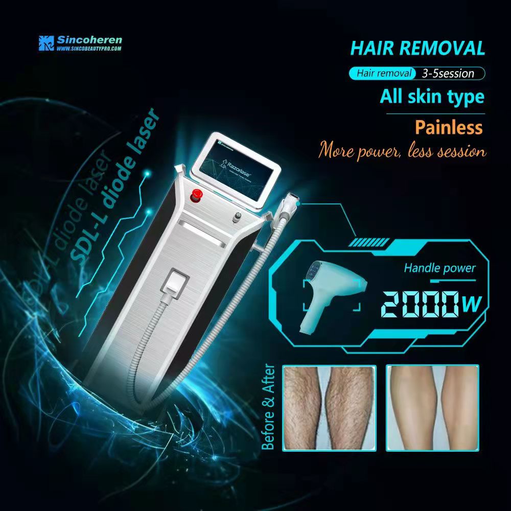 Combien de temps une machine d'épilation au laser diode peut-elle durer ? 